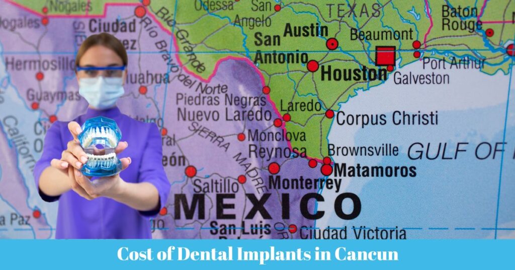 Cost of Dental Implants in Cancun