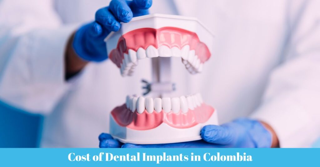 Cost of Dental Implants in Colombia